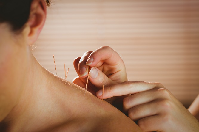 acupuncture-can-be-a-great-alternative-to-medical-care