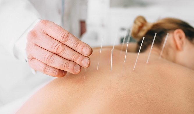 how-acupuncture-can-help-anxiety