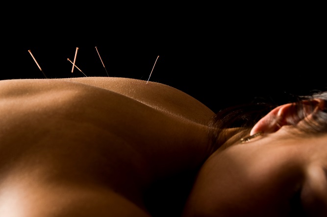 learning-the-basics-of-acupuncture