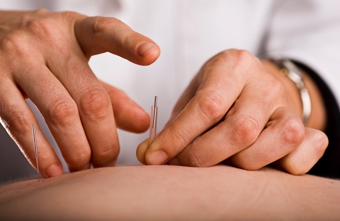 acupuncture-in-complementary-and-alternative-medicine