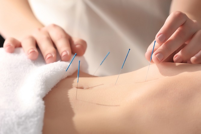 getting-to-know-the-different-types-of-acupuncture